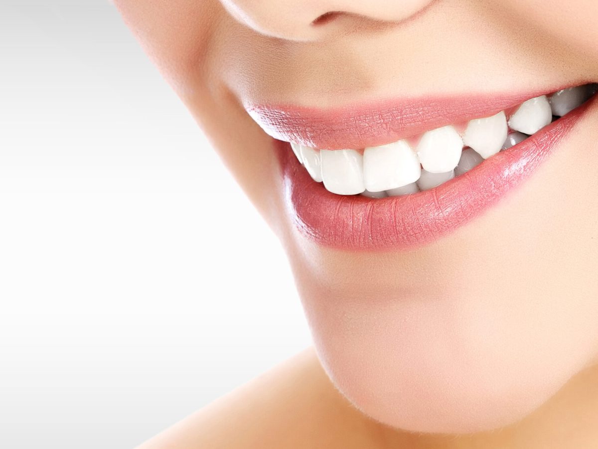 Teeth whitening for a beautiful&nbsp;smile